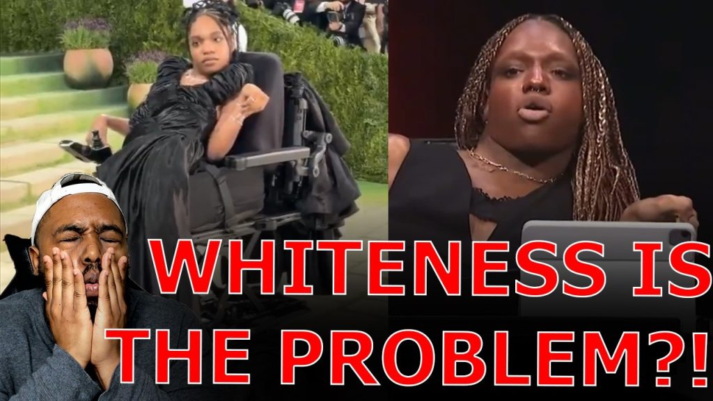 Black Transgender Disabled Migrant Woman Blames White People For Not Getting Hired As A Model!