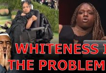 Black Transgender Disabled Migrant Woman Blames White People For Not Getting Hired As A Model!